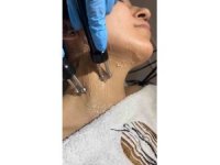 Güzellikte yeni trend: mikro akım