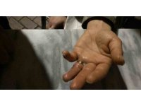 Parmağına yüzük sıkışan sahsa itfaiye ekiplerinden müdahale