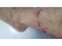 Başıboş köpeklerin saldırısına uğradı