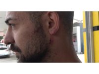 Kavgayı ayırmak isterken kulağından ısırıldı