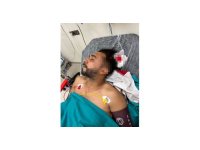 Adana’da döner ustası çalışırken başından yorgun mermiyle yaralandı