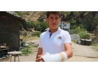 Orman yangınında alevler evine sıçramasın can pahasına diye mücadele veren çocuğun elini yamaçtan kopan kaya parçası kırdı
