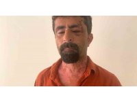 Antalya’da öfkeli damat kayınpederini hastanelik etti