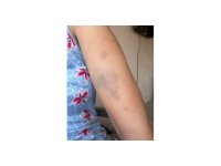 Veteriner ve ailesine ‘Sokak köpeklerini besledin’ dayağı iddiası